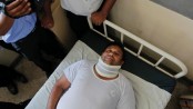Lawmakers injured in fisticuffs inside Sri Lanka parliament